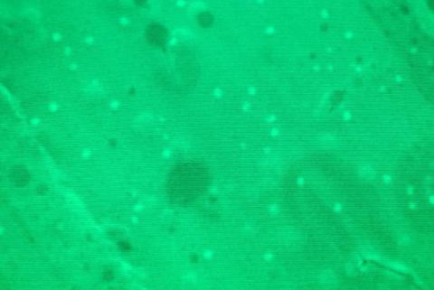 Microplastiche al microscopio